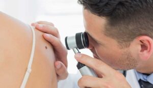 Какими заболеваниями занимается дерматолог?