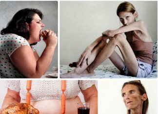 Методы лечения булимии