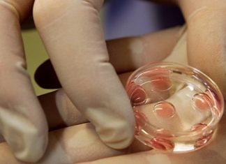 Что представляет собой ЭКО?