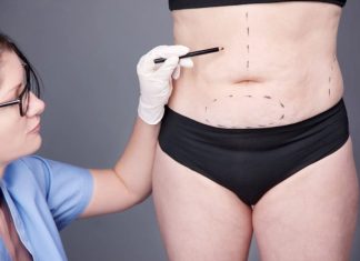 Где сделать липосакцию живота в Санкт-Петербурге и что нужно знать об этой процедуре