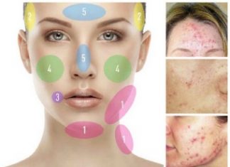 Причины возникновения прыщей на подбородке