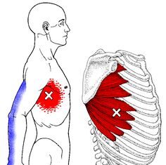 Боль в ребрах — в чем может быть причина?