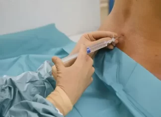 Преимущества эпидуральной анестезии