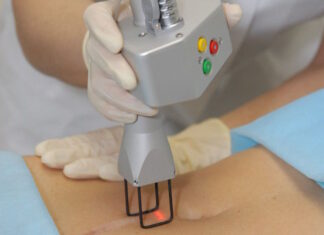 Методы лазерного удаления шрамов