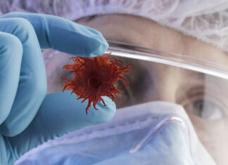 Лечение рака в Израиле :особенности подхода