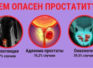 Самые эффективные схемы лечения простатита