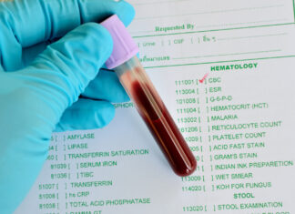 Для чего нужен общий анализ крови?