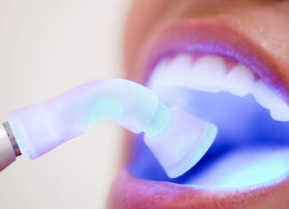 Виды отбеливания зубов в стоматологии