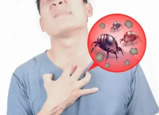 Что такое аллергия на клещей?